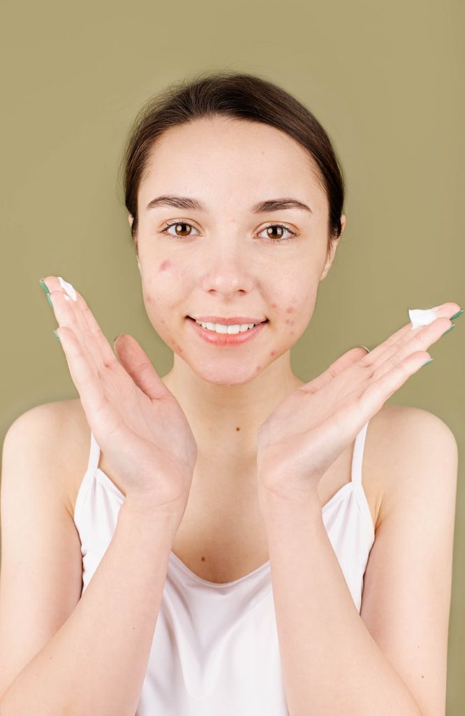 أكثر من 15 طريقة لإزالة آثار حبوب الوجه نهائياً